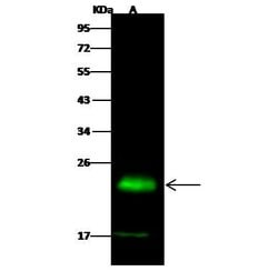 PMVK Recombinant Rabbit Monoclonal Antibody (014) 100 &mu;L | Buy Online | Thermo Scientific | Fisher Scientific