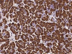 Invitrogen PNLIP Recombinant Rabbit Monoclonal Antibody (120) 100 &mu;L;