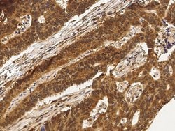 Invitrogen PPIL1 Recombinant Rabbit Monoclonal Antibody (003) 100 &mu;L | Buy Online | Invitrogen&trade; | Fisher Scientific