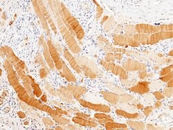 Invitrogen PPM1G Recombinant Rabbit Monoclonal Antibody (112) 100 &mu;L;