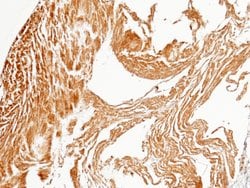 Invitrogen PPM1G Recombinant Rabbit Monoclonal Antibody (112) 100 &mu;L;