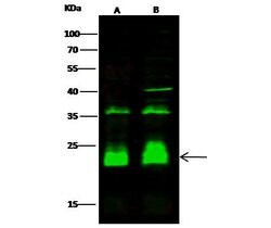 Invitrogen PPM1G Recombinant Rabbit Monoclonal Antibody (112) 100 &mu;L;
