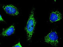 Invitrogen PRDX5 Recombinant Rabbit Monoclonal Antibody (002) 100 &mu;L;