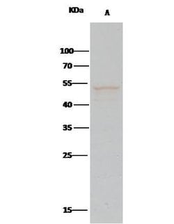 Invitrogen PTP1B Recombinant Rabbit Monoclonal Antibody (226) 100 &mu;L | Buy Online | Invitrogen&trade; | Fisher Scientific