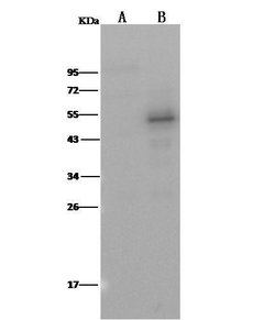 Invitrogen PTP1B Recombinant Rabbit Monoclonal Antibody (226) 100 &mu;L | Buy Online | Invitrogen&trade; | Fisher Scientific