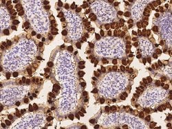 Invitrogen REG4 Recombinant Rabbit Monoclonal Antibody (244) 100 &mu;L;