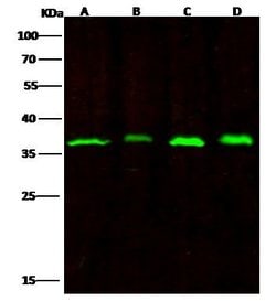 Invitrogen RPRD1B Monoclonal Antibody (01) 100 &mu;L; Unconjugated:Antibodies,