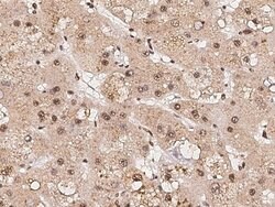 Invitrogen RPRD1B Monoclonal Antibody (08) 100 &mu;L; Unconjugated:Antibodies,