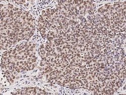 Invitrogen RPRD1B Monoclonal Antibody (08) 100 &mu;L; Unconjugated:Antibodies,