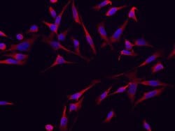 Invitrogen RRM1 Monoclonal Antibody (08) 100 &mu;L; Unconjugated:Antibodies,