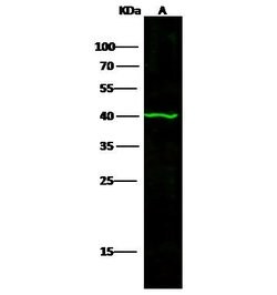 Invitrogen p53R2 Monoclonal Antibody (04) 100 &mu;L; Unconjugated:Antibodies,
