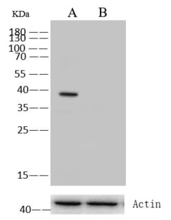 Invitrogen p53R2 Monoclonal Antibody (04) 100 &mu;L; Unconjugated:Antibodies,