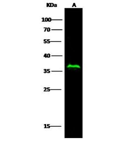 Invitrogen p53R2 Recombinant Rabbit Monoclonal Antibody (074) 100 &mu;L;