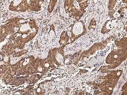 Invitrogen RUVBL1 Monoclonal Antibody (01) 100 &mu;L; Unconjugated:Antibodies,