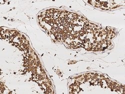 Invitrogen RUVBL1 Monoclonal Antibody (01) 100 &mu;L; Unconjugated:Antibodies,
