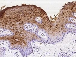 Invitrogen S100A7 Monoclonal Antibody (3E3H12F9) 100 &mu;L; Unconjugated:Antibodies,