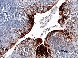 Invitrogen S100A7 Recombinant Rabbit Monoclonal Antibody (129) 100 &mu;L;