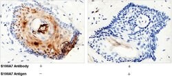 Invitrogen S100A7 Recombinant Rabbit Monoclonal Antibody (129) 100 &mu;L;