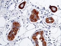 Invitrogen S100A7 Recombinant Rabbit Monoclonal Antibody (129) 100 &mu;L;