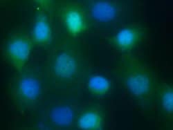 Invitrogen S100A9 Monoclonal Antibody (01) 100 &mu;L; Unconjugated:Antibodies