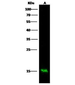 Invitrogen S100A9 Recombinant Rabbit Monoclonal Antibody (018) 100 &mu;L;
