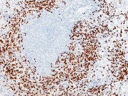 Invitrogen S100A9 Recombinant Rabbit Monoclonal Antibody (209) 100 &mu;L;