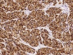 Invitrogen S100B Monoclonal Antibody (60) 100 &mu;L; Unconjugated:Antibodies,