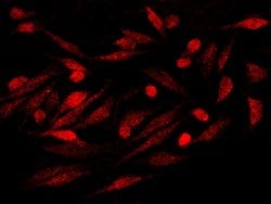 Invitrogen S100P Recombinant Rabbit Monoclonal Antibody (116) 100 &mu;L;