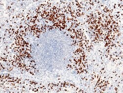 Invitrogen S100P Recombinant Rabbit Monoclonal Antibody (116) 100 &mu;L;