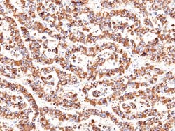 Invitrogen Heparin Cofactor II Monoclonal Antibody (07) 100 &mu;L; Unconjugated:Antibodies,