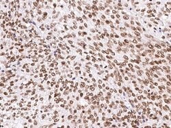 Invitrogen SIRT1 Monoclonal Antibody (3H10A10) 100 &mu;L | Buy Online | Invitrogen&trade; | Fisher Scientific