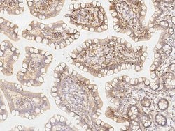 Invitrogen CD98 Monoclonal Antibody (04) 100 &mu;L; Unconjugated:Antibodies,