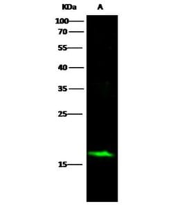 Invitrogen alpha Synuclein Recombinant Rabbit Monoclonal Antibody (017)