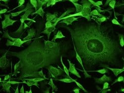 Invitrogen SOD1 Recombinant Rabbit Monoclonal Antibody (101) 100 &mu;L | Buy Online | Invitrogen&trade; | Fisher Scientific