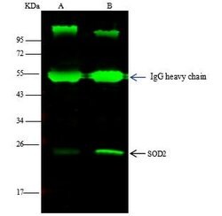 Invitrogen SOD2 Recombinant Rabbit Monoclonal Antibody (001) 100 &mu;L;