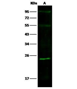 Invitrogen SOD2 Recombinant Rabbit Monoclonal Antibody (001) 100 &mu;L;