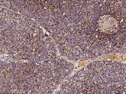 Invitrogen SOD2 Recombinant Rabbit Monoclonal Antibody (012) 100 &mu;L;