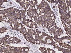Invitrogen SOD2 Recombinant Rabbit Monoclonal Antibody (012) 100 &mu;L;