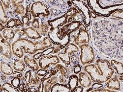 Invitrogen SOD2 Recombinant Rabbit Monoclonal Antibody (012) 100 &mu;L;