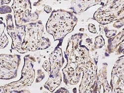 Invitrogen SOD2 Recombinant Rabbit Monoclonal Antibody (012) 100 &mu;L;
