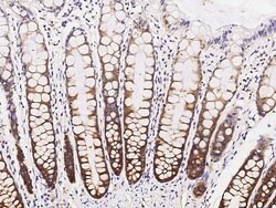 Invitrogen SRPK1 Monoclonal Antibody (08) 100 &mu;L; Unconjugated:Antibodies,