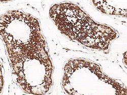 Invitrogen SRPK1 Monoclonal Antibody (08) 100 &mu;L; Unconjugated:Antibodies,