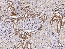 Invitrogen ST6GAL1 Recombinant Rabbit Monoclonal Antibody (036) 100 &mu;L;