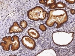 Invitrogen ST6GAL1 Recombinant Rabbit Monoclonal Antibody (036) 100 &mu;L;