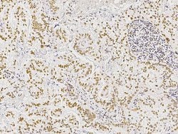 Invitrogen MST1 (STK4) Recombinant Rabbit Monoclonal Antibody (025) 100