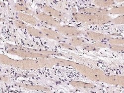 Invitrogen STUB1 Recombinant Rabbit Monoclonal Antibody (006) 100 &mu;L | Buy Online | Invitrogen&trade; | Fisher Scientific