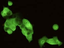 Invitrogen STUB1 Recombinant Rabbit Monoclonal Antibody (034) 100 &mu;L;