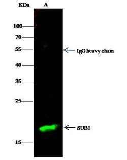 Invitrogen PC4 Monoclonal Antibody (04) 100 &mu;L; Unconjugated:Antibodies,