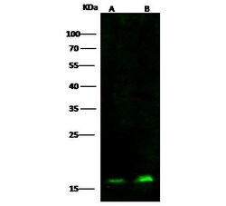 Invitrogen PC4 Monoclonal Antibody (04) 100 &mu;L; Unconjugated:Antibodies,
