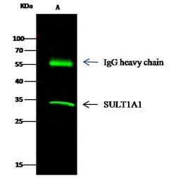 Invitrogen SULT1A1 Monoclonal Antibody (3C5H6) 100 &mu;L; Unconjugated:Antibodies,